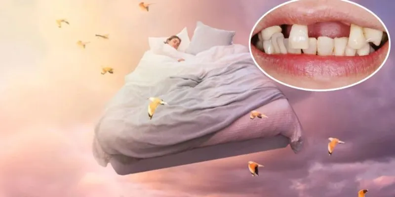 Nằm mơ rụng răng có thể là điềm lành tài chính